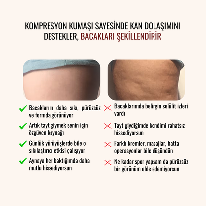 Anti-Selülit Konfor Taytı Flexlif
