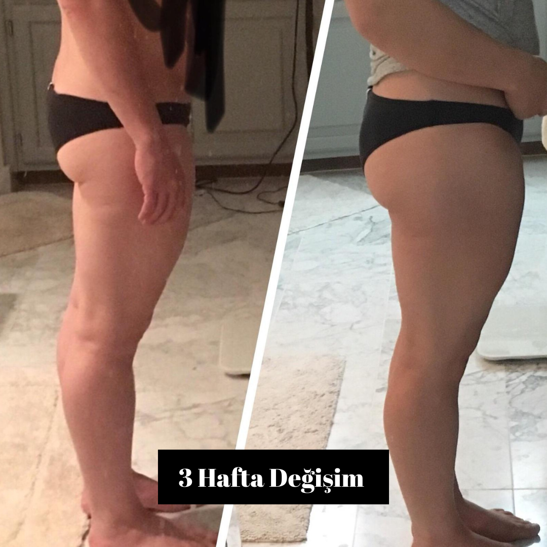 Kalça Sıkılaştırıcı Şekillendirici - Zahmetsizce Kalçanızı Şekillendirin!