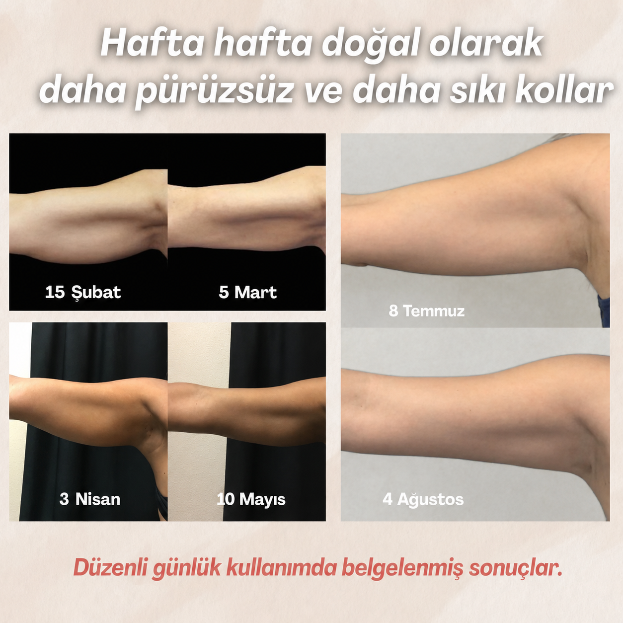 3D şekillendirici kolluklar – artık sarkık kollara son!