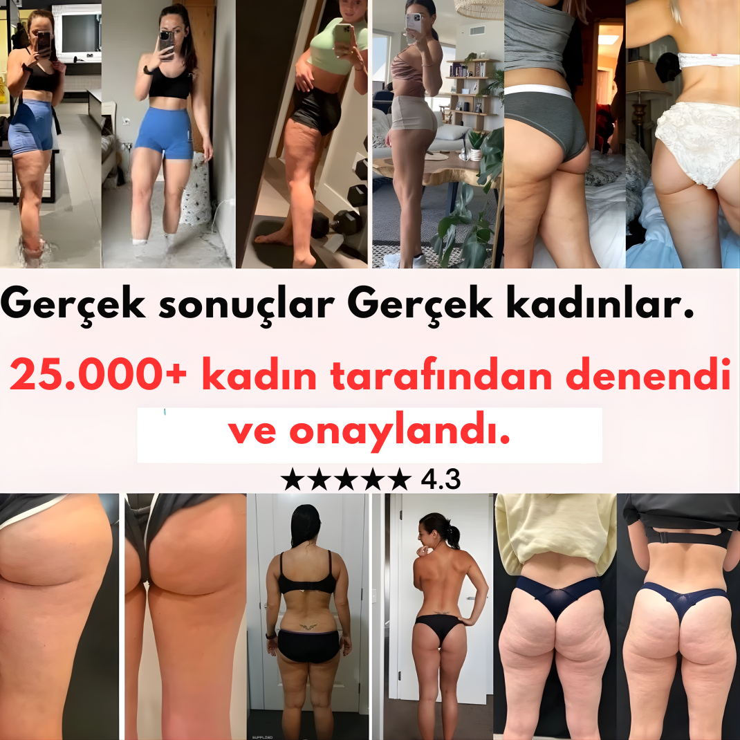 ©Flexlif 4'ü Bir Arada Etki Tayt - Selülit, Varis, Lipödem, Zayıflama