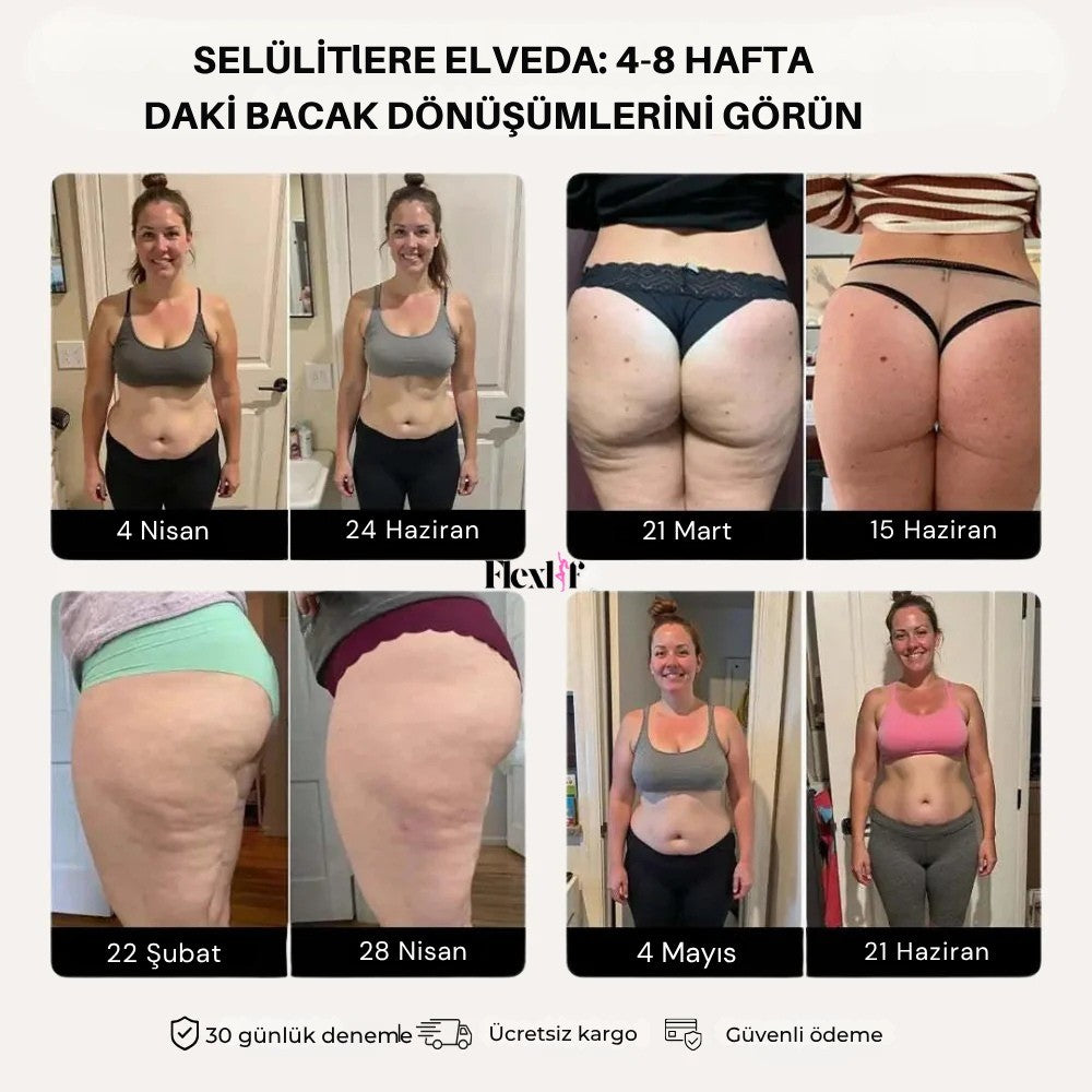 ©Flexlif 3'ü Bir Arada Etki Tayt - Selülit, Varis, Lipödem